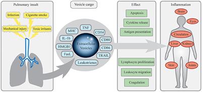 Pulmonary Extracellular Vesicles as Mediators of Local and Systemic Inflammation